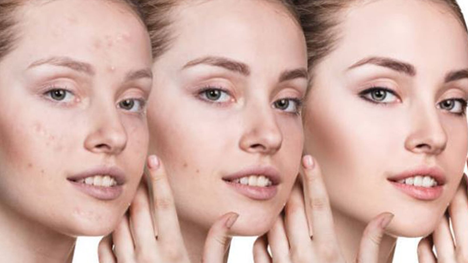 Maestría en dermatología estética